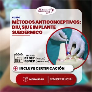 Métodos anticonceptivos: diu, siu e implante subdérmico