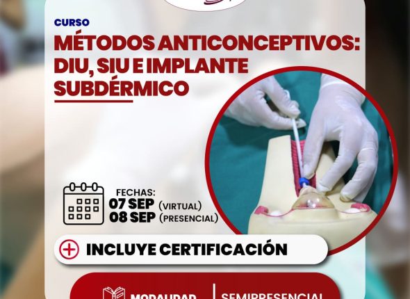 Métodos anticonceptivos: diu, siu e implante subdérmico