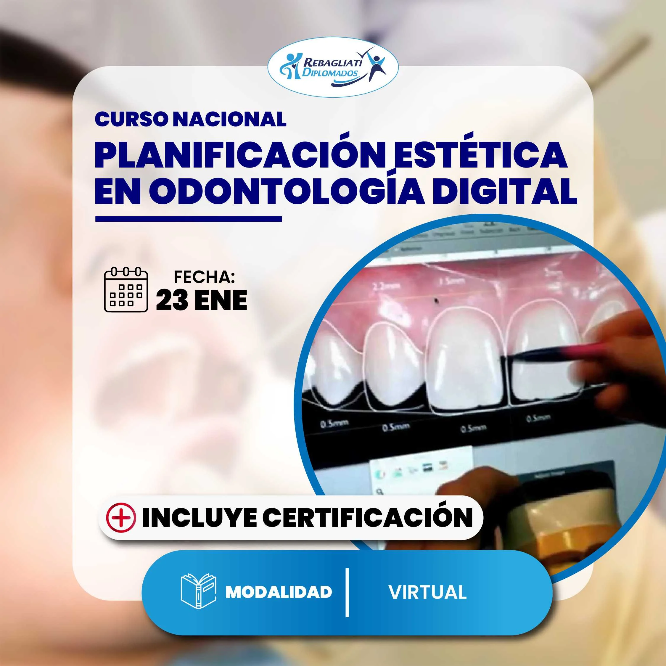 Curso nacional planificación estética en odontología digital